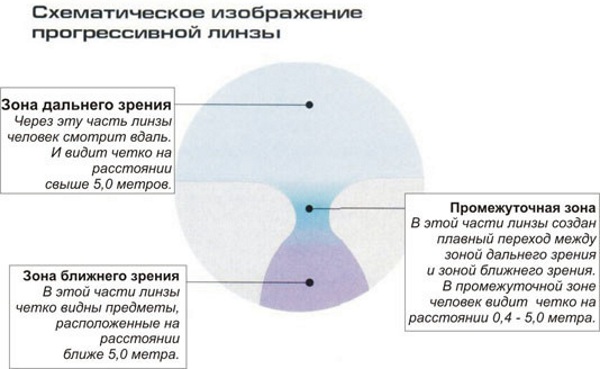 Бифокальные (мульти) линзы для глаз контактные. Что это такое, как подобрать