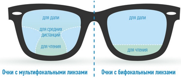 Бифокальные (мульти) линзы для глаз контактные. Что это такое, как подобрать