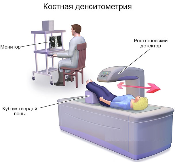 Болезнь Шляттера коленного сустава у подростка, взрослых, детей. Что это такое, признаки, лечение