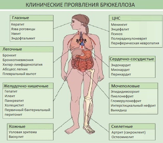 Зоонозные инфекции. Что это такое, как передаются человеку, лечение