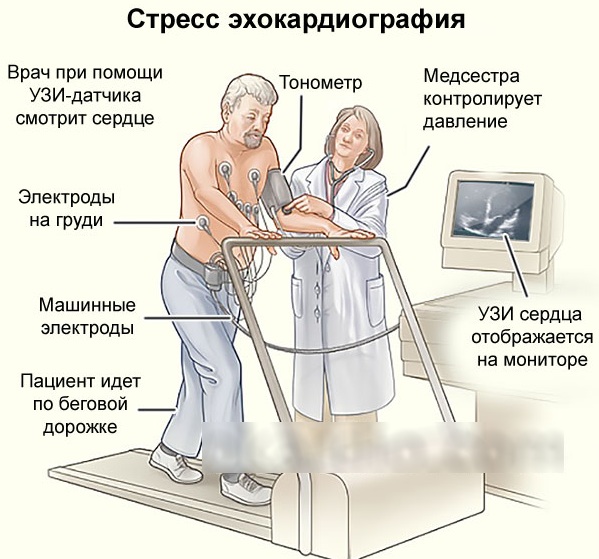 ЭХО (эхокардиография) сердца. Что показывает, нормальные показатели, как делают