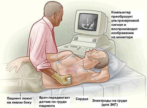 ЭХО (эхокардиография) сердца. Что показывает, нормальные показатели, как делают