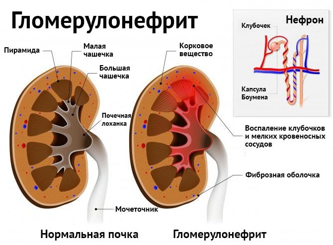 СКФ норма у женщин, мужчин, детей по возрасту. Таблица