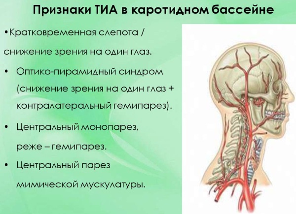 Транзиторная ишемическая атака карта вызова скорой медицинской