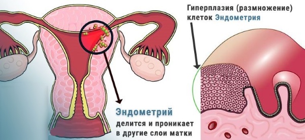 Заболевания шейки матки. Список, классификация, клинические рекомендации