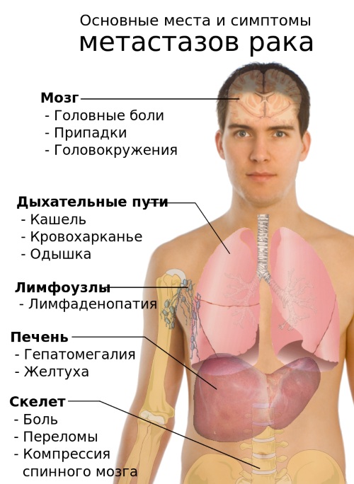 Миелоциты в анализе крови. Что это у ребенка, взрослого, норма, повышены, расшифровка