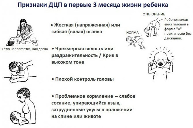 Перинатальная энцефалопатия. Что это такое у детей, взрослых, симптомы, последствия