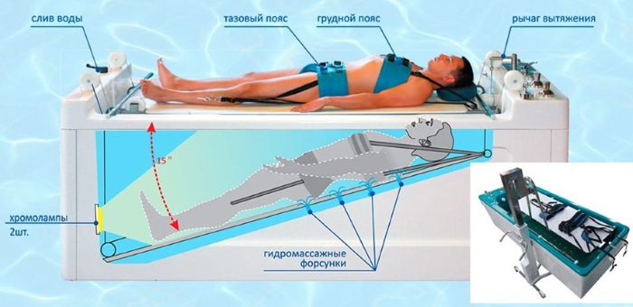 Подводное вытяжение позвоночника. Показания и противопоказания, как проходит, отзывы