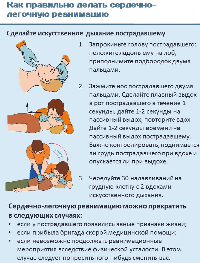 Терминальное состояние человека. Что это, стадии, способы первой помощи