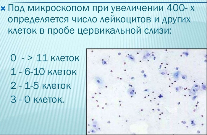 Цервикальная слизь. Что это при овуляции и после, перед месячными, нормы по дням цикла