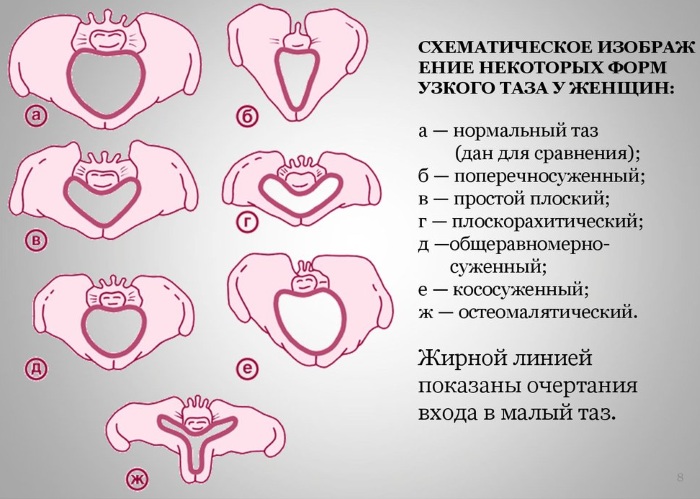 Женский таз в акушерстве. Строение, размеры, плоскости, нормы, отличия от мужского, фото