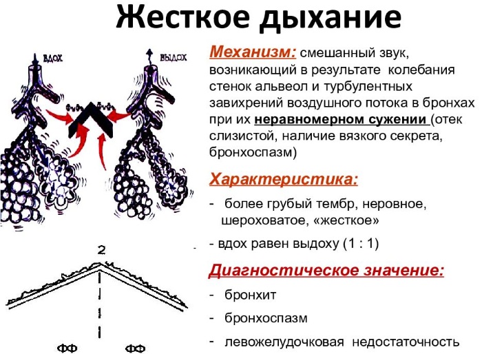 Жесткое дыхание у ребенка. Как лечить, что значит с кашлем, температурой, причины