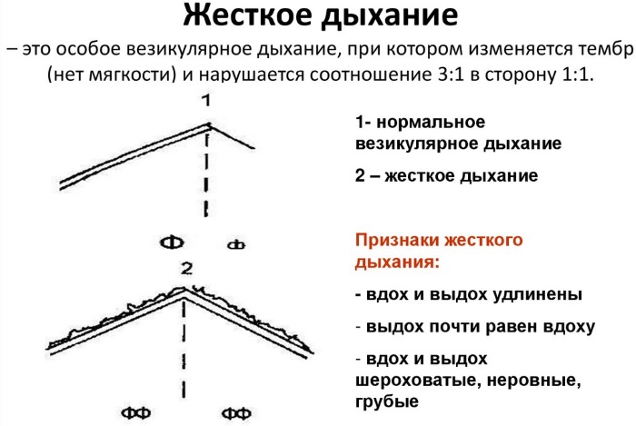 Жесткое дыхание у ребенка. Как лечить, что значит с кашлем, температурой, причины