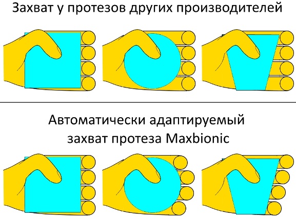 Бионический протез руки. Цены, как работают, где купить, изготовители