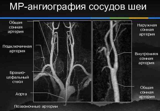 Боль в висках пульсирующая, в затылке, глазах: причины и лечение