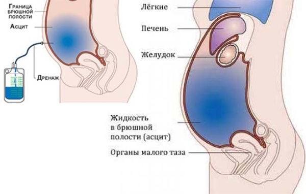 Брюшная полость человека. Анатомия, какие органы, функции, УЗИ, МРТ, заболевания