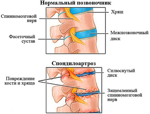 Эльбона (Elbona). Инструкция по применению, отзывы больных, цена