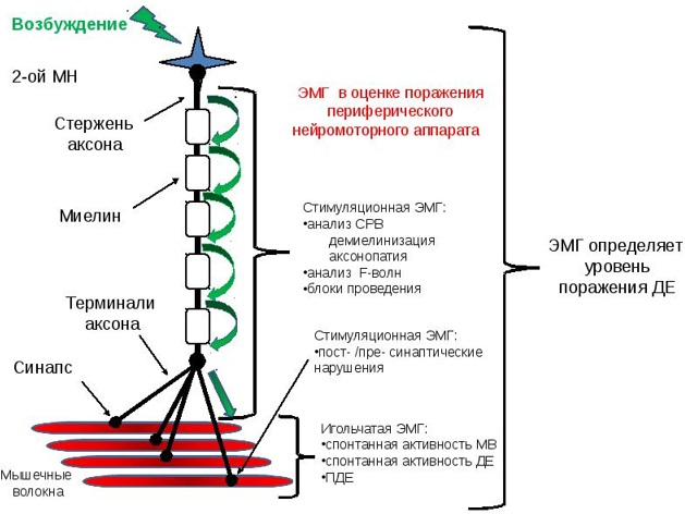 ЭНМГ нижних/верхних конечностей. Что это такое, цена обследования, как делают