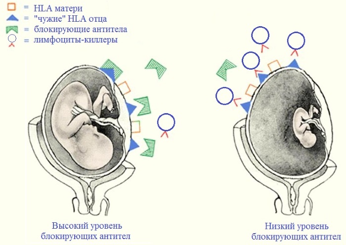 HLA типирование супругов. Что это такое, цена, анализ на генетическую совместимость, классы, расшифровка, как подготовиться