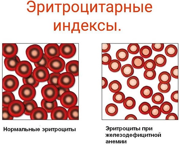 MCHC в анализе крови понижен у взрослого, женщин, ребенка. Причины, что значит