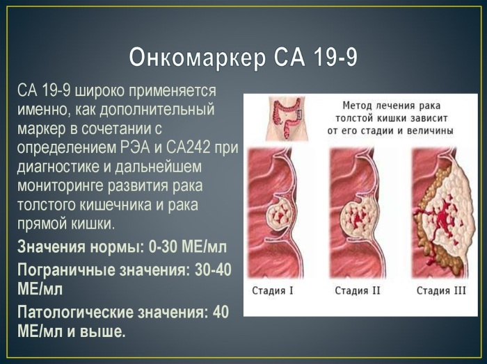 Онкомаркер СА 19-9. Что показывает, означает, норма, как сдавать, расшифровка