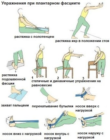 Плантарный фасциит. Симптомы и лечение народными средствами, медикаментами, массажем, гимнастикой