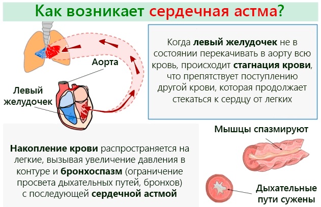 Пульс 180-190-200-210-220 ударов в минуту в состоянии покоя, при беге, нагрузке. Что это значит, причины, лечение взрослого, ребенка