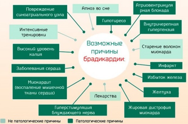 Пульс 55-60-70-80 ударов в минуту у женщин. Это нормально или нет, что значит