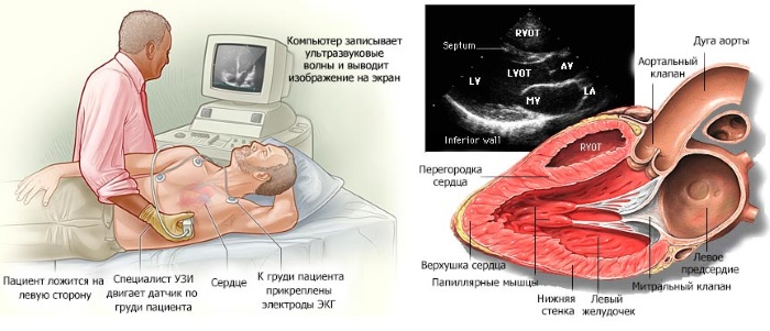 Пульс 55-60-70-80 ударов в минуту у женщин. Это нормально или нет, что значит