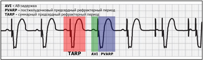 Пульс 55-60-70-80 ударов в минуту у женщин. Это нормально или нет, что значит