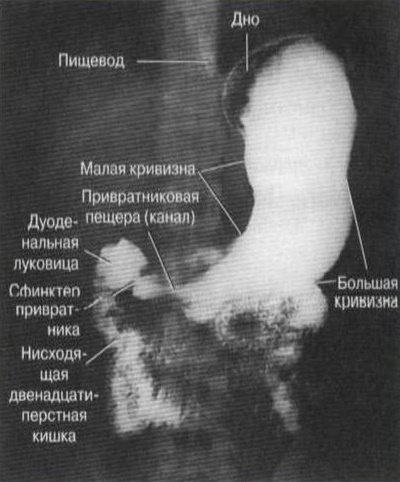 Рентгеноскопия желудка. Что это такое, подготовка к исследованию, как делается, что показывает