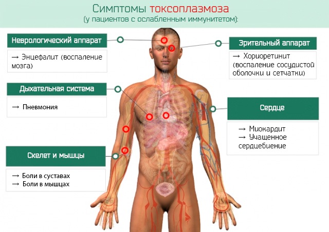 Токсоплазмоз у женщин. Симптомы и лечение