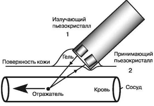 УЗДС вен нижних конечностей. Что это такое, как делают, подготовка, цена