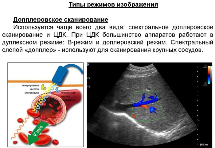 УЗДС вен нижних конечностей. Что это такое, как делают, подготовка, цена