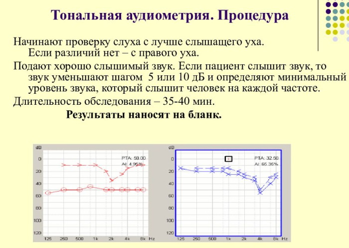 Вода в ухе. Как избавиться, если не выходит неделю после купания, болит, что делать, лекарства