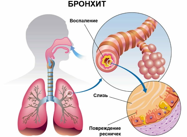 АмброГЕКСАЛ (AmbroHEXAL) сироп для детей. Инструкция по применению, цена, отзывы