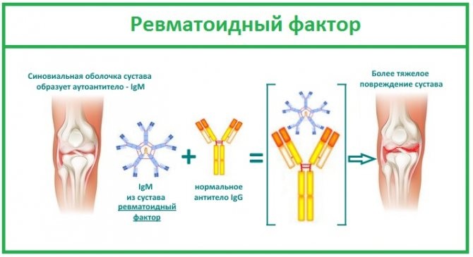 Анализ на ревмопробы. Цена, что показывает, расшифровка, как сдавать, подготовка