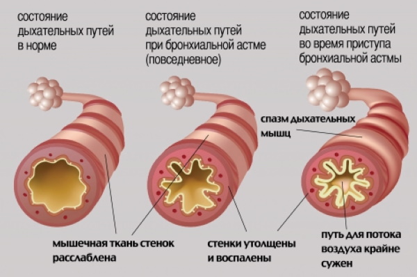 L-лизина эсцинат. Инструкция по применению при внутривенном введении, цена, отзывы, аналоги