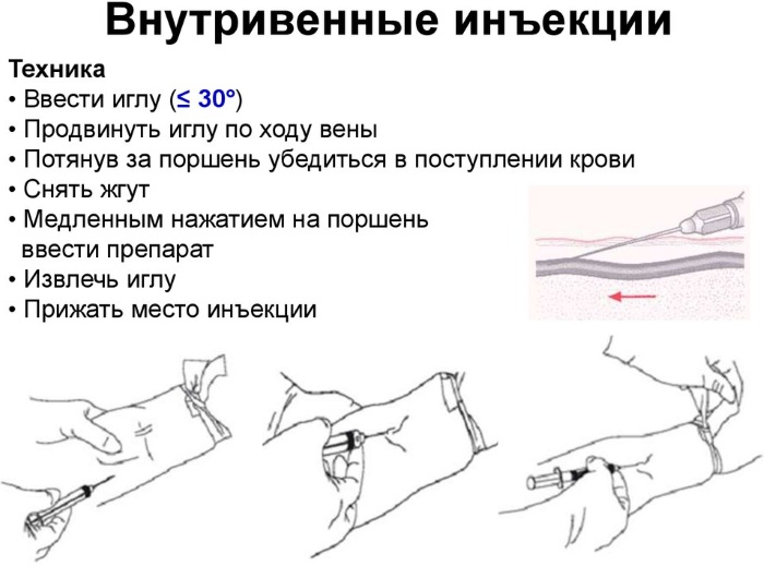 Болюсное введение препаратов. Что это такое в косметологии, медицине, в чем отличия при КТ