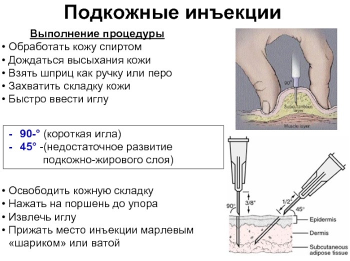 Болюсное введение препаратов. Что это такое в косметологии, медицине, в чем отличия при КТ