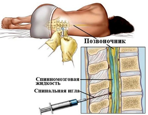 Болюсное введение препаратов. Что это такое в косметологии, медицине, в чем отличия при КТ