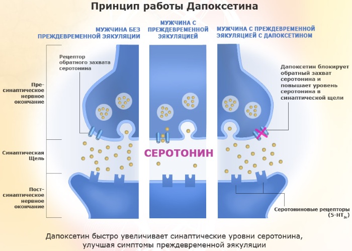 Дапоксетин: аналоги российские без рецептов. Цены, отзывы