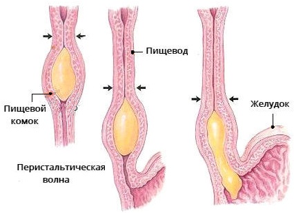 Дисфагия пищевода. Симптомы и лечение, что это такое, причины