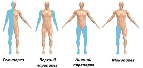 Дистальный и проксимальный. Что это в анатомии, стоматологии, отдел, лучелоктевой сустав, каналец, конец