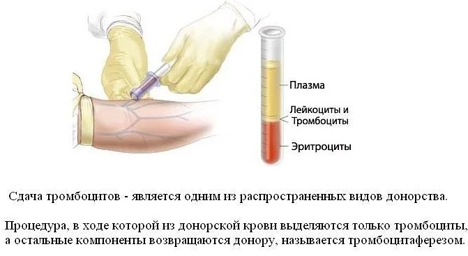 Донорство крови. Плюсы и минусы для организма, как часто можно, сколько платят, требования