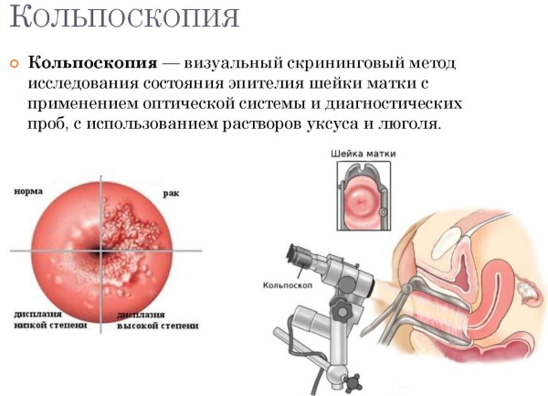 Две матки у женщин. Что это такое, можно ли забеременеть, причины, УЗИ