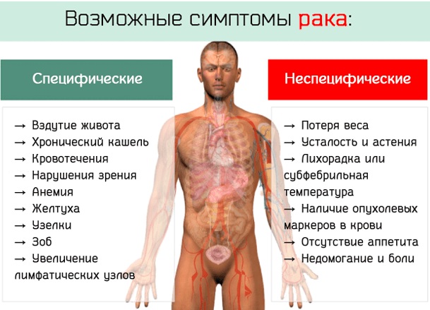 Экспансивный рост опухоли. Что это такое, для чего характерен, чем характеризуется, сопровождается