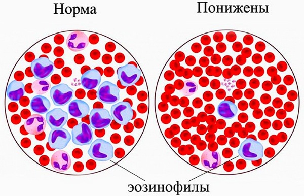 Эозинофилы понижены у женщины, взрослого, ребенка. Что это значит, как повысить