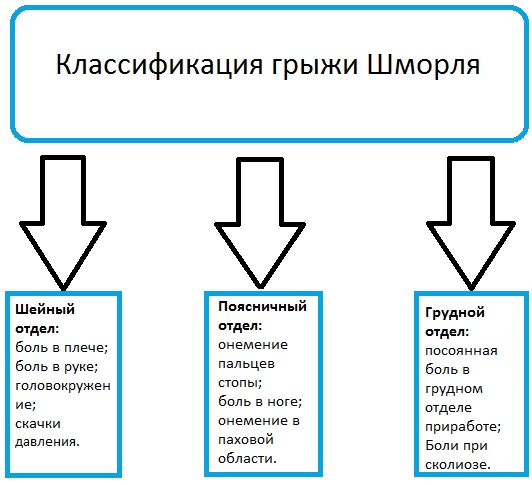 Грыжа Шморля на позвоночнике. Фото, что это такое, симптомы и лечение, опасность