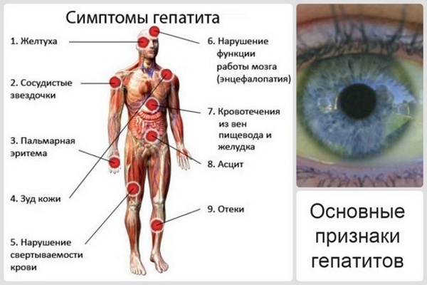 Хронический гепатит. Внепеченочные признаки, симптомы, патогенез, осложнения